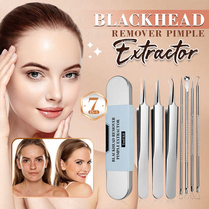 Medical grade blackhead cell clip tool set - Sale 50% Off