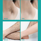 🔥Limited Sale-Buy 2 Get 1 Free!🎁Painless Full Body Hair Removal Cream 💧✨