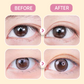 ✨Buy 1 Get 1 Free✨Invisible Strong Support Double Eyelid Tapes for Enlarging Eyes