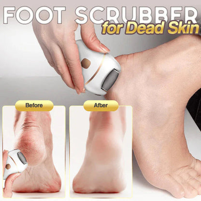 🔥HOT SALE 50% OFF🔥Rechargeable Electric Foot Exfoliating Scrubber