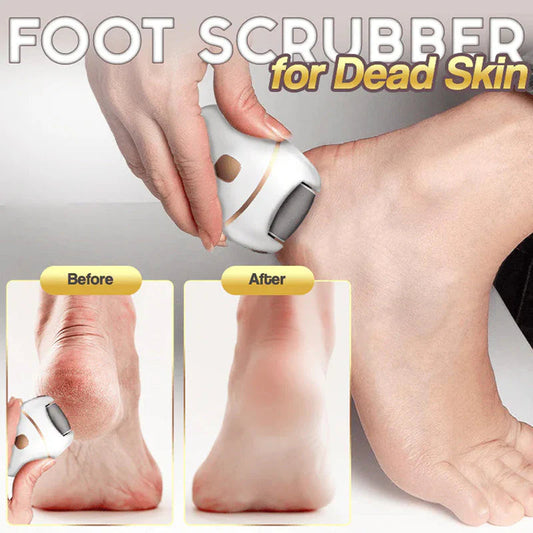 🔥HOT SALE 50% OFF🔥Rechargeable Electric Foot Exfoliating Scrubber