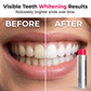 😁50K+ SOLD!🦷50% OFF! ☕Stain‑Removing Whitening Mouthwash – Lifts coffee & tea stains, alcohol‑free. Instant gunk binding, long‑lasting minty fresh. Gentle enough for daily use. 🦷