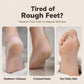 🥳HOT SALE🥳💞10K+ SOLD! Foot Remover – From £17.99! 3-in-1, nano glass & dual speed. Soft, smooth feet – grab yours! ✅